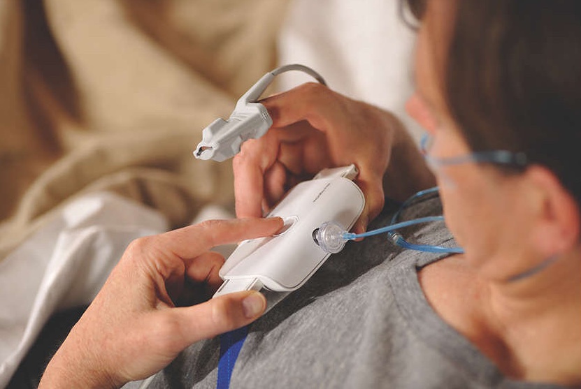 Sleep Apnea Testing at home with the Alice NightOnce Device