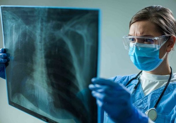 Pulmonary Function Testing services. Woman looking at an x-ray.